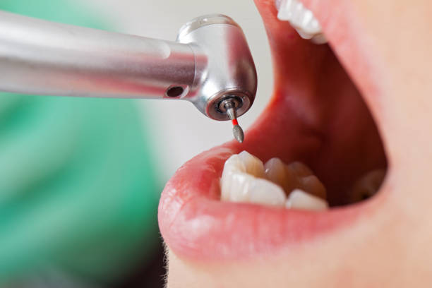 Best Walk-In Emergency Dentist in Cleveland Heights, OH